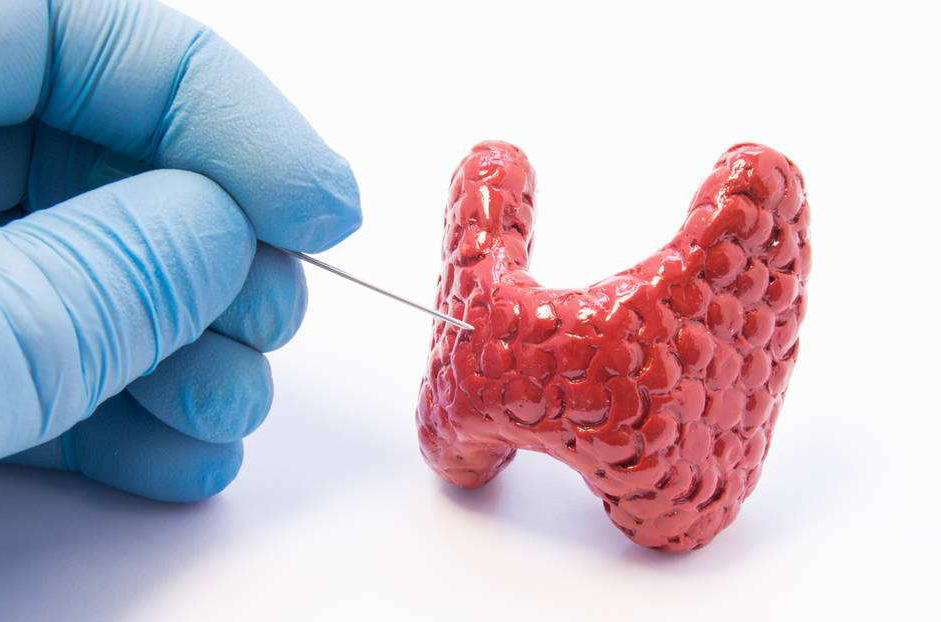 甲状腺癌3.jpg