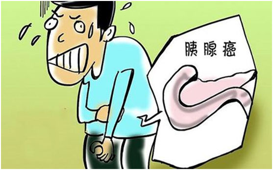 胰腺癌