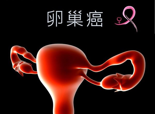 卵巢癌 (15).jpg