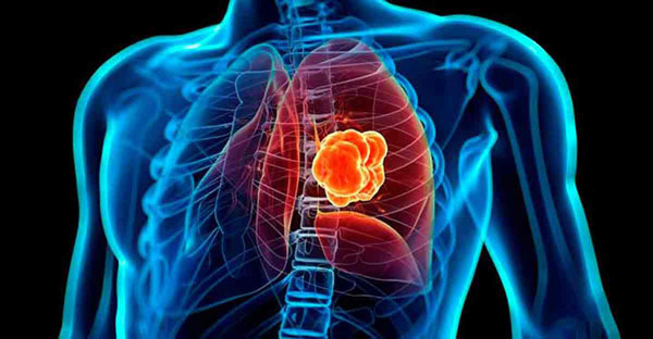 test-heredar-cancer-1.jpg