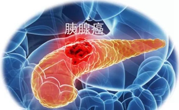 v2-310c2ea5b90e4c43191a487ba84bcf42_1200x500.jpg