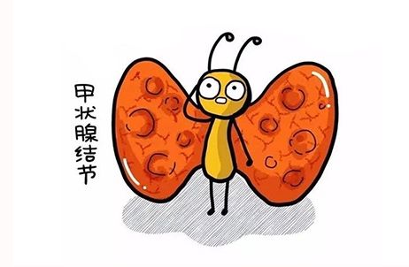 甲状腺癌7.jpg