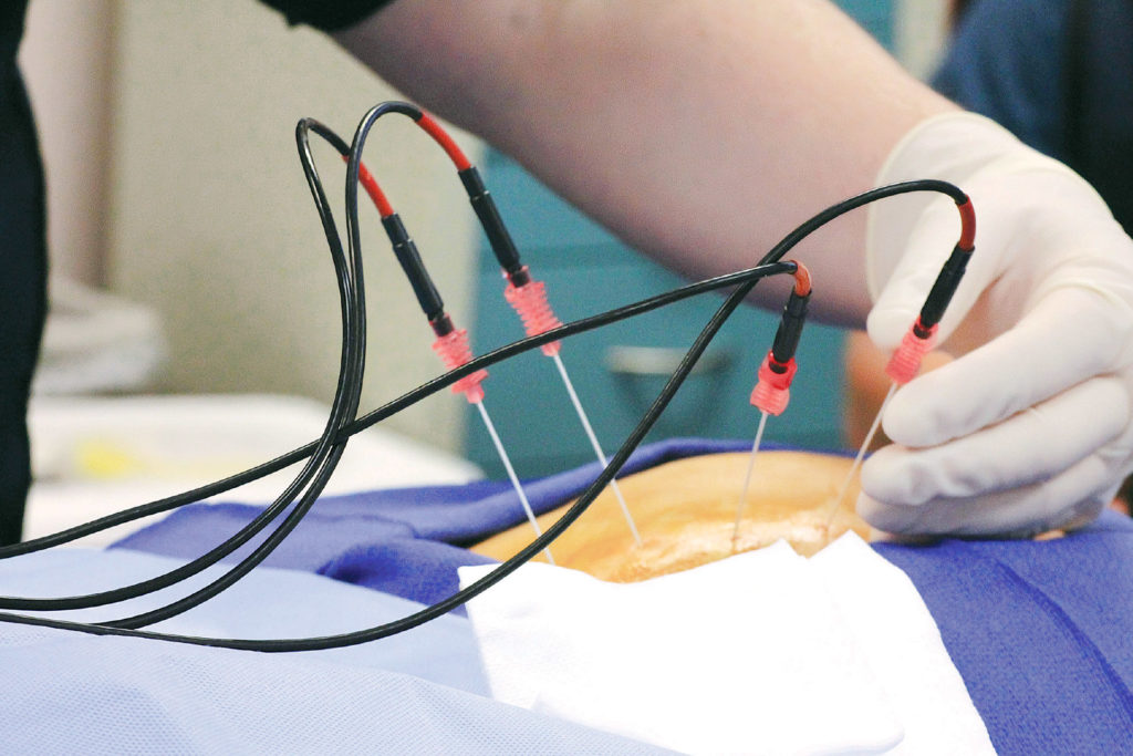 medworld-clinic-radiofrequency-1024x683-1.jpg