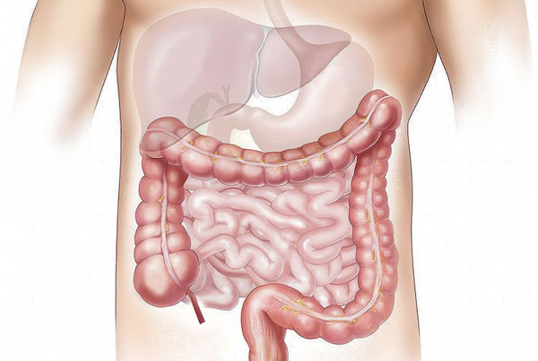 colon.jpg