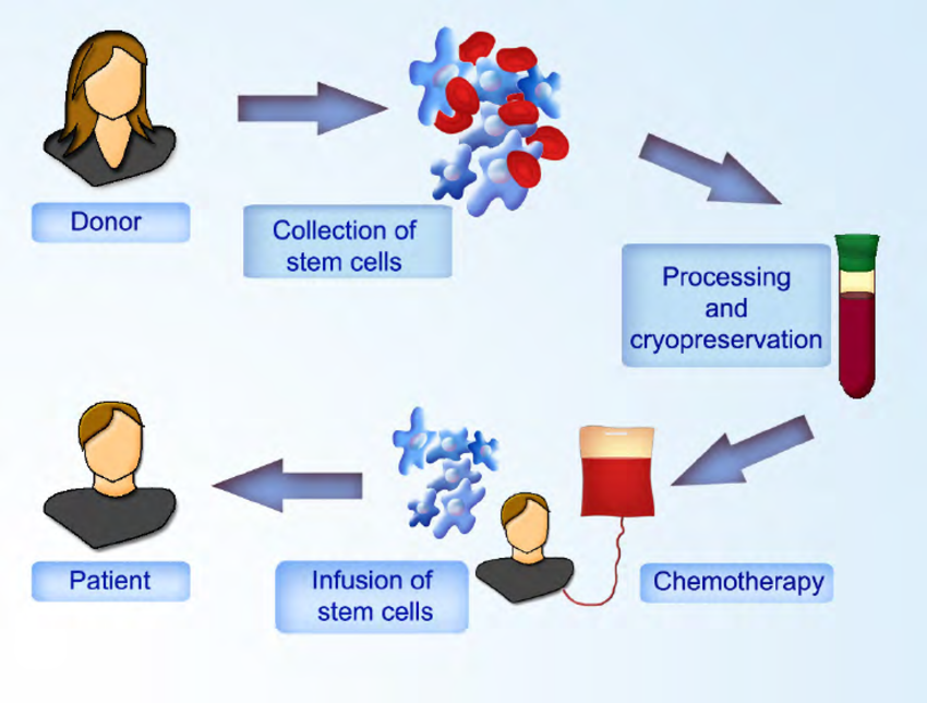 Allogeneic-stem-cell-transplantation-Hematopoietic-stem-cells-are-collected-from-the.png