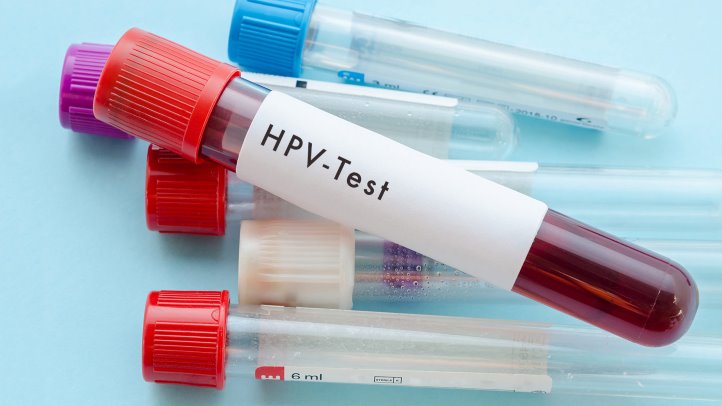 HPV检查.jpg