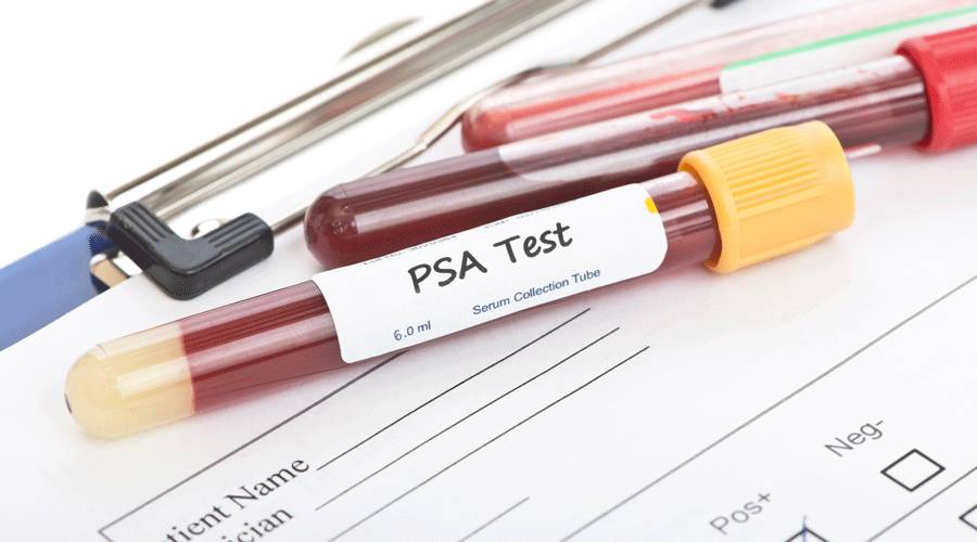 前列腺癌PSA1.jpg